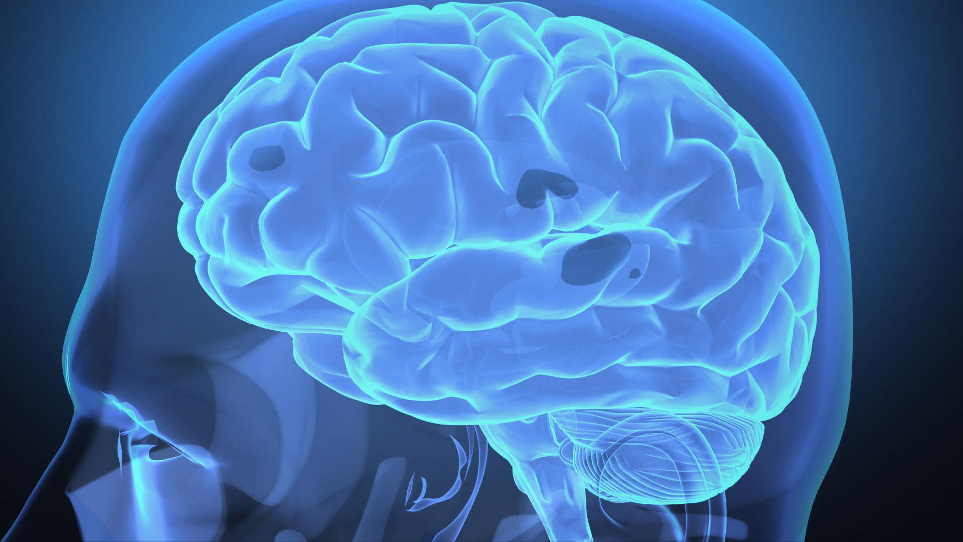 Bilde av hjernen - hode i profil